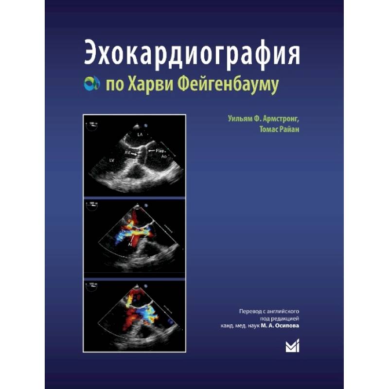 Эхокардиография по Харви Фейгенбауму