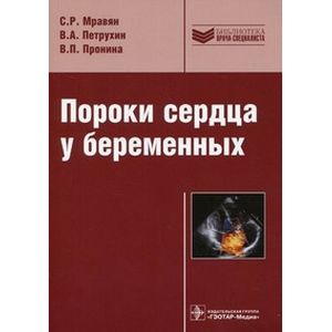 Пороки сердца у беременных