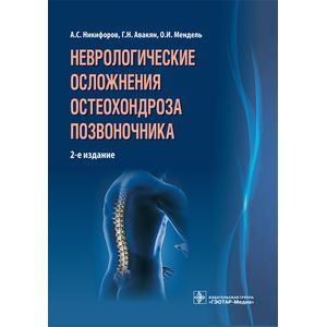 Неврологические осложнения остеохондроза позвоночника.