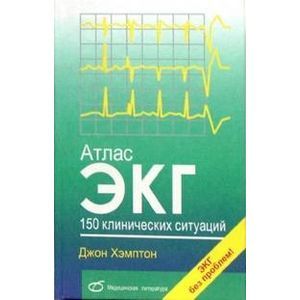 Атлас ЭКГ. 150 клинических ситуаций