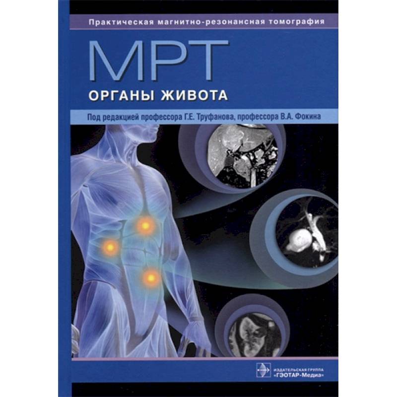 МРТ. Органы живота. Руководство