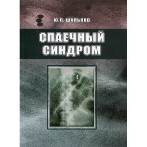 Спаечный синдром