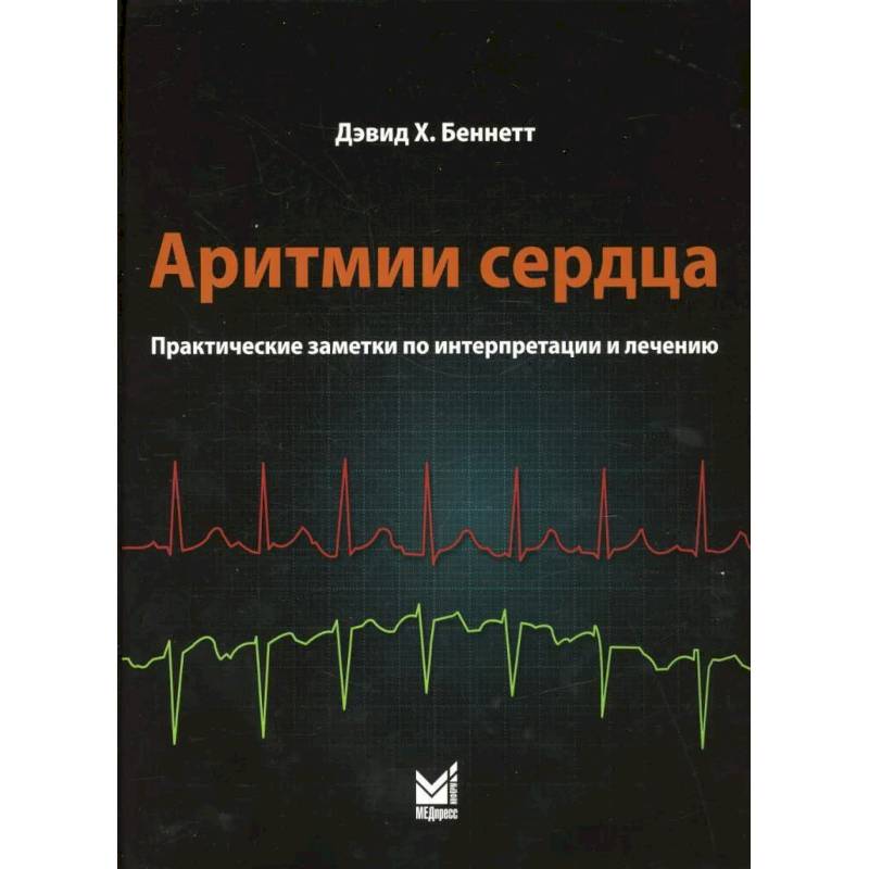 Скачать бесплатно Белялов Ф.И. - Аритмии сердца pdf