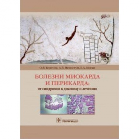 Кардиология, книга Болезни миокарда и перикарда. От синдромов к диагнозу и лечению купить по скидке