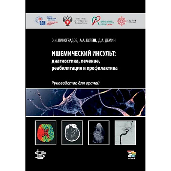 Ишемический инсульт: диагностика, лечение, реабилитация и профилактика. Руководство для врачей