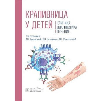 Крапивница у детей. Клиника. Диагностика. Лечение