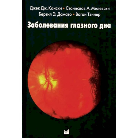 Офтальмология, книга Заболевания глазного дна купить по скидке